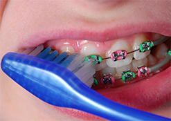 Brushing teeth with braces